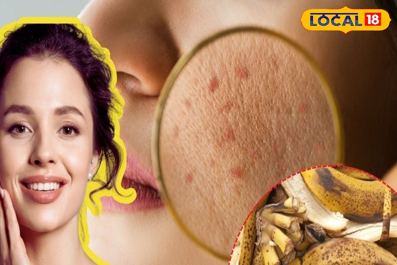 इसके साथ ही यह चेहरे की ग्लोइंग में मददगार होता है