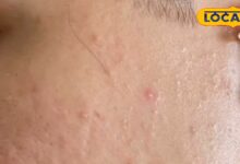 उम्र और हार्मोनल बदलाव के कारण खो रही है चेहरे की रंगत? अपनाएं ये तरीके, लौट आएगा नेचुरल ग्लो - Rajasthan News