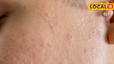 उम्र और हार्मोनल बदलाव के कारण खो रही है चेहरे की रंगत? अपनाएं ये तरीके, लौट आएगा नेचुरल ग्लो - Rajasthan News