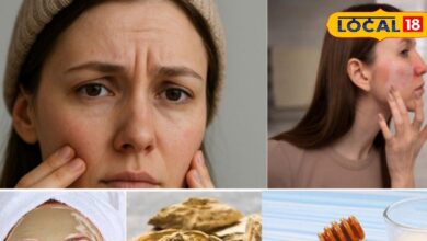 सर्दियों में चेहरे का कालापन कैसे दूर करें | Winter Skin Care Tips for Glowing Skin