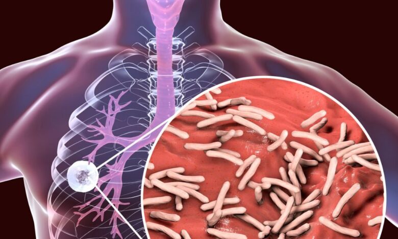 How TB Bacteria Evade Antibiotics IIT Bombay Study Finds | टीबी बैक्टीरिया दवाओं को कैसे देते हैं धोखा IIT बॉम्बे की स्टडी में खुलासा