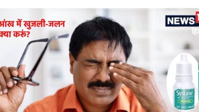 आंखों में खुजली और जलन है या हो रहीं ड्राई आईज, डॉ. तितियाल ने बताई 3 आई ड्रॉप, कोई भी डालें, मिलेगा फायदा