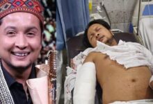 'कार में लगी आग,मैं अंदर था', पवनदीप राजन ने पहली बार बताया रोड एक्सीडेंट का सच, दिया अपना हेल्थ अपडेट