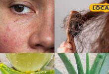 ठंड में रूखी त्वचा और झड़ते बाल? एलोवेरा सबसे असरदार, ऐसे करें इस्तेमाल - Chhattisgarh News