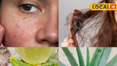 ठंड में रूखी त्वचा और झड़ते बाल? एलोवेरा सबसे असरदार, ऐसे करें इस्तेमाल - Chhattisgarh News