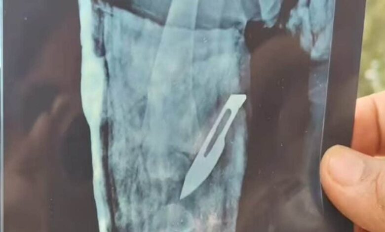 डॉक्टरों की गलती या सिस्टम की चूक? राजस्थान के अस्पतालों में मरीजों के साथ ये क्या हो रहा है?