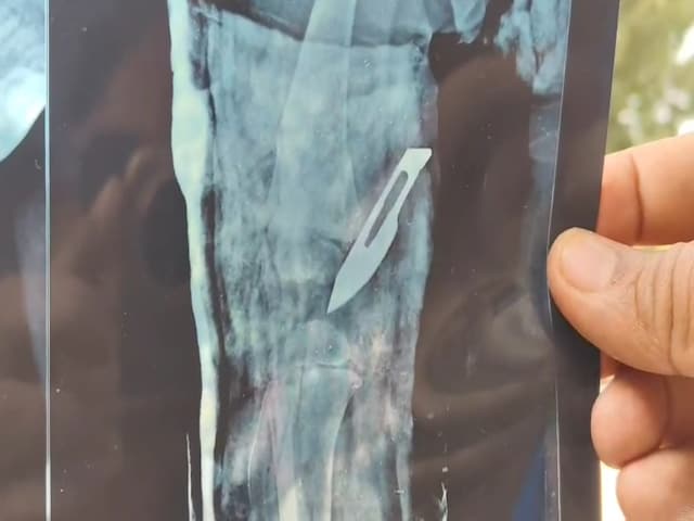 दर्द से कराहता बच्चा, एक्स-रे ने खोली सच्चाई! इलाज के नाम पर भयंकर लापरवाही? दर्द से कराहता बच्चा, एक्स-रे ने खोली सच्चाई! इलाज के नाम पर भयंकर लापरवाही?