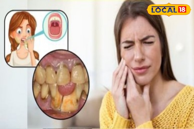 डेंटल हाइजीन और लाइफस्टाइल के जरिए इनका ध्यान रखा जा सकता है