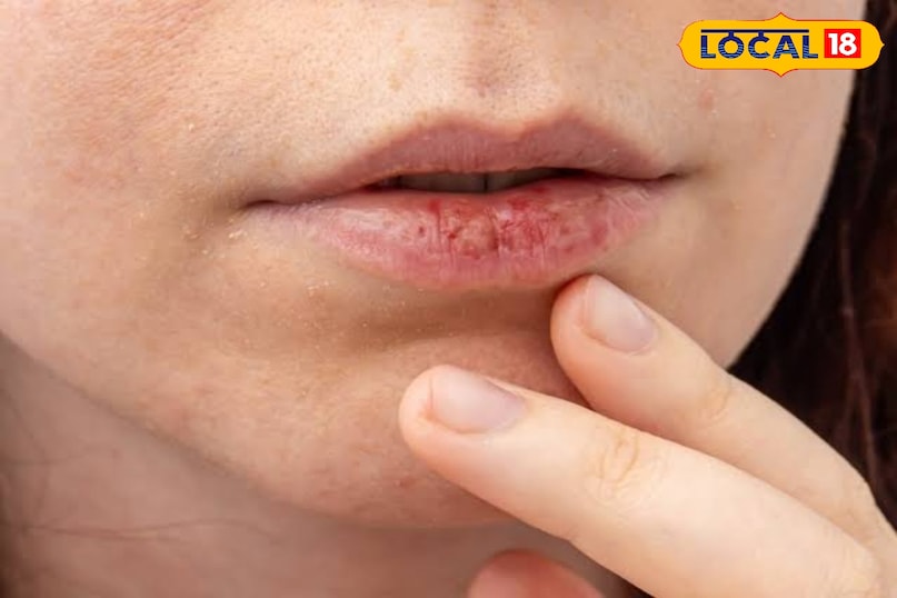 रुखे होठ 