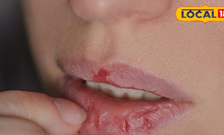 सर्दियों में होंठ सूख या फट रहे हैं? अपनाएं ये घरेलू नुस्खे, ठंडी हवा से बचाएंगे और होंठ बनाएंगे मुलायम और गुलाबी