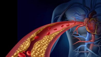 Lower Your Cholesterol: गंदे कोलेस्ट्रॉल को बिना दवा-इलाज कैसे कम करें?