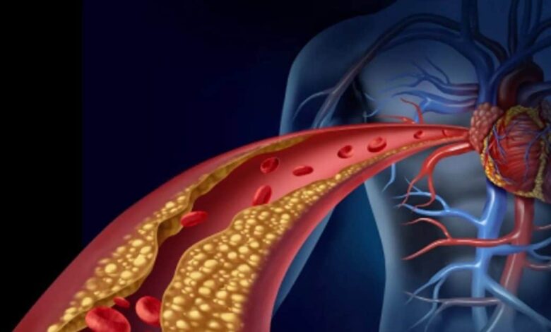 Lower Your Cholesterol: गंदे कोलेस्ट्रॉल को बिना दवा-इलाज कैसे कम करें?