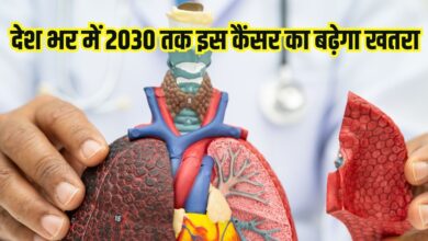 Lung cancer cases rise sharply by 2030: देश भर में 2030 तक इस कैंसर का बढ़ेगा खतरा, हाई रिस्क में होंगी महिलाएं