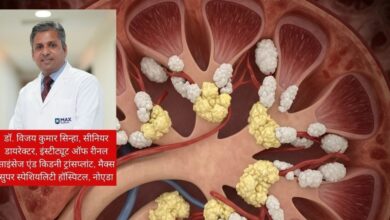 My creatinine is 4.77 mg/dL: किडनी में क्रिएटिनिन बढ़ने के कारण, लक्षण और बचाव के उपाय.