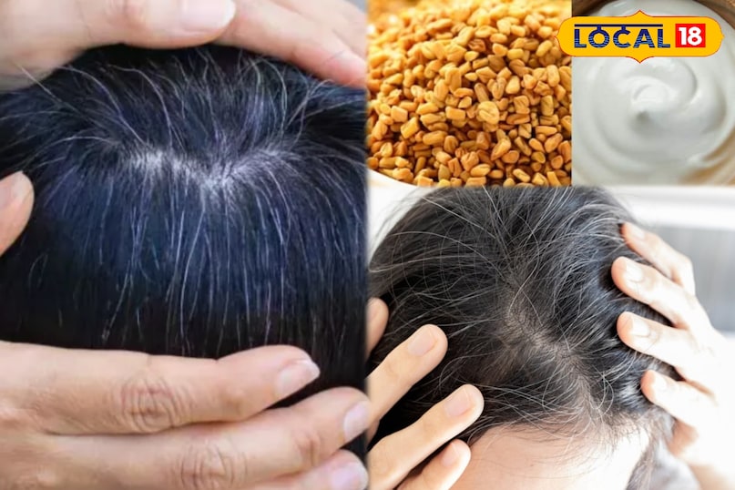 बच्चों से लेकर बड़ों तक बाल झड़ने का देसी इलाज, अपनाएं दही-मेथी का उपाय...