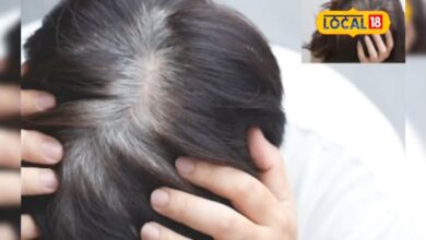 बाली उमर में सफेद हो रहे बाल? यह घरेलू नुस्खा दिलाएगा आराम..! 5 चीजों से तैयार, हफ्ते में एक बार करें इस्तेमाल