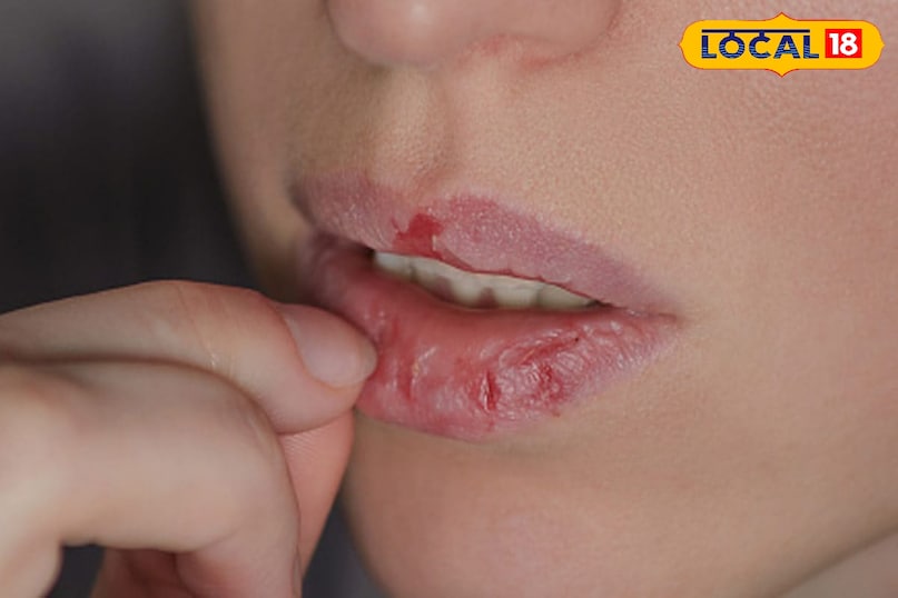 रूखे होठ 