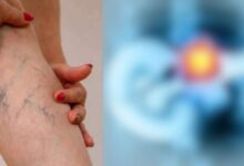 आंखों या त्वचा का पीला पड़ना, भूख कम लगना, तेजी से वजन घटना, पेट दर्द या मल त्याग में बदलाव जैसे संकेत भी अग्नाशय कैंसर से जुड़े हो सकते हैं.