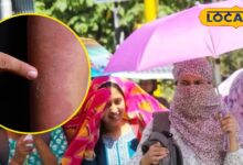 Skincare Tips: धूप से खराब हो रही स्किन? आसान घरेलू उपायों से मिलेगा नैचुरल ग्लो और पूरी सुरक्षा