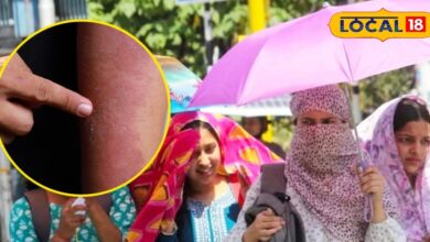 Skincare Tips: धूप से खराब हो रही स्किन? आसान घरेलू उपायों से मिलेगा नैचुरल ग्लो और पूरी सुरक्षा