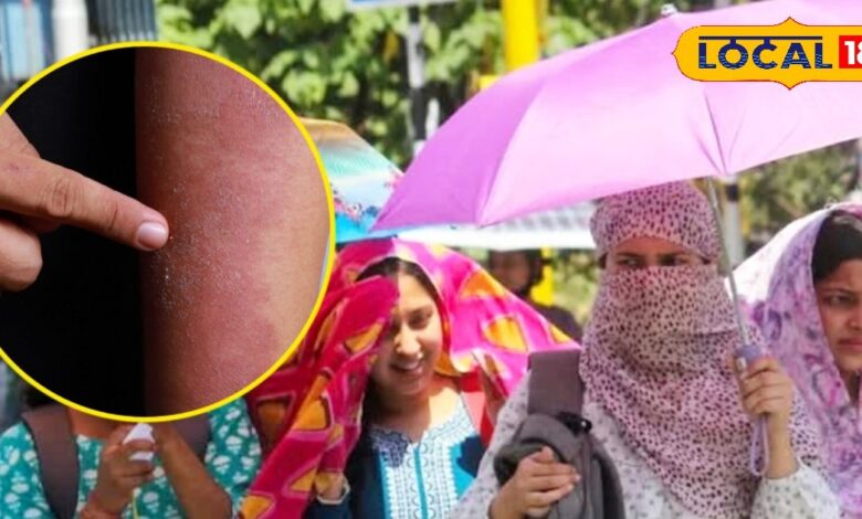 Skincare Tips: धूप से खराब हो रही स्किन? आसान घरेलू उपायों से मिलेगा नैचुरल ग्लो और पूरी सुरक्षा