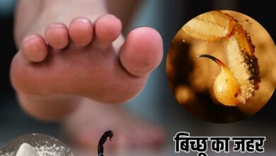 Tips To treat scorpion poisoning: तुरंत उतर जाएगा बिच्छू का जहर, करें ये 5 रामबाण उपाय