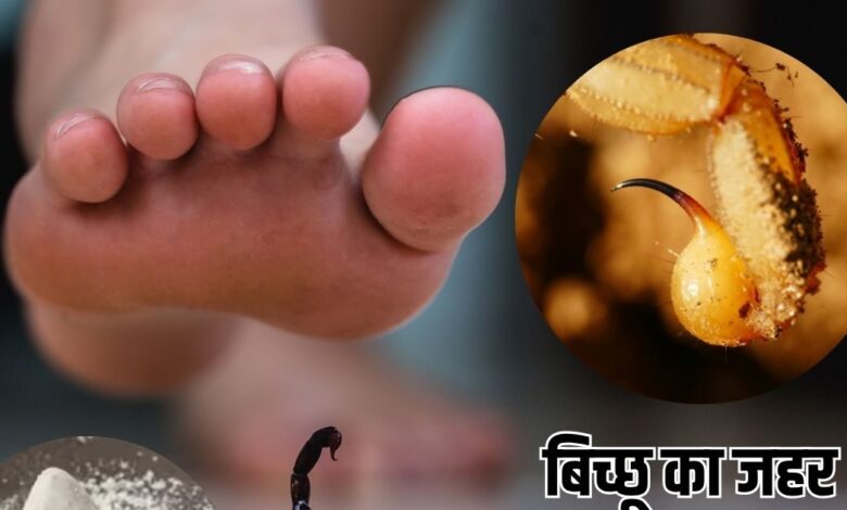Tips To treat scorpion poisoning: तुरंत उतर जाएगा बिच्छू का जहर, करें ये 5 रामबाण उपाय