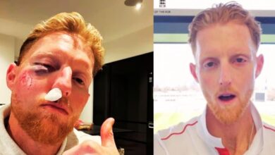 VIDEO: सर्जरी के बाद बेन स्टोक्स का चेहरा पूरी तरह से बदला, पहली नजर में देखने पर लगेगा झटका