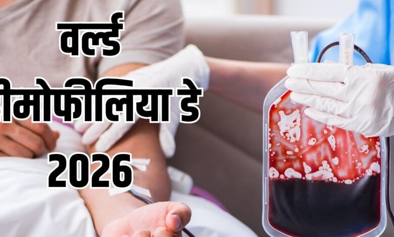 World Hemophilia Day 2026: क्या है खून को पतला करने वाली बीमारी हीमोफीलिया, इन लक्षणों को नजरअंदाज साबित हो सकता है जानलेवा