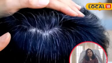 कम उम्र में बाल हो रहे हैं सफेद, तो आयुर्वेदिक डॉक्टर ने जानिए कारण और बचाव के आसान उपाय