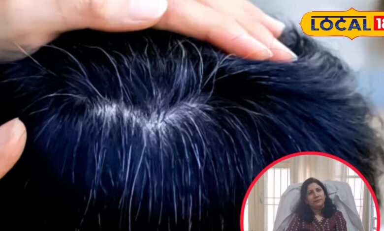 कम उम्र में बाल हो रहे हैं सफेद, तो आयुर्वेदिक डॉक्टर ने जानिए कारण और बचाव के आसान उपाय