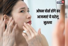 कम उम्र में स्किन पर नजर आ रहे ओपन पोर्स, स्टेप बाई स्टेप फॉलो करें ये घरेलू नुस्खा, पाएं दमकती त्वचा