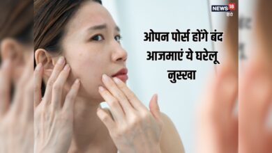 कम उम्र में स्किन पर नजर आ रहे ओपन पोर्स, स्टेप बाई स्टेप फॉलो करें ये घरेलू नुस्खा, पाएं दमकती त्वचा