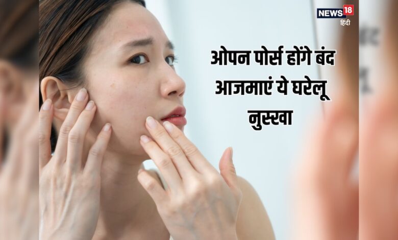 कम उम्र में स्किन पर नजर आ रहे ओपन पोर्स, स्टेप बाई स्टेप फॉलो करें ये घरेलू नुस्खा, पाएं दमकती त्वचा