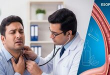 डॉक्टर के पास गया एसिडिटी का इलाज कराने, निकल गया कैंसर, समय रहते बच गई जान, आपके साथ हो ऐसा तो क्या करेंगे