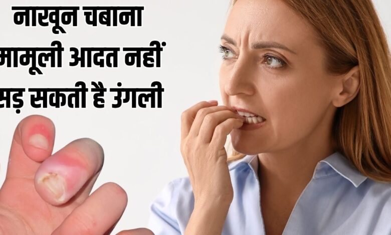 नाखून चबाने की आदत से सड़ने लगी उंगली, 21 साल की लड़की का छलका दर्द, जानें कितना खतरनाक नेल बाइटिंग