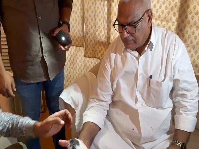 बीजेपी अध्यक्ष के स्वागत में नेता को लगी चोट, मदद के लिए खुद आ गए नितिन नवीन!