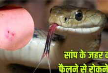 First Aid For A Snakebite: सांप के काटने पर जहर को शरीर में फैलने से रोकने का उपाय