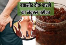 बवासीर होने पर क्या खाना चाहिए क्या नहीं? बिना सर्जरी पाइल्स ठीक करने का तरीका