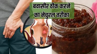 बवासीर होने पर क्या खाना चाहिए क्या नहीं? बिना सर्जरी पाइल्स ठीक करने का तरीका
