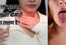 गर्मी में बार-बार गला सूखना, नॉर्मल या किस बीमारी का संकेत? एक्सपर्ट से जानें