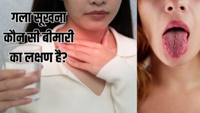 गर्मी में बार-बार गला सूखना, नॉर्मल या किस बीमारी का संकेत? एक्सपर्ट से जानें