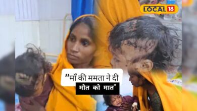 मदर्स डे पर मां बनी ढाल, कुत्ते से भिड़कर लहूलुहान बेटी को बचाया, सिर पर लगे 12 टांके