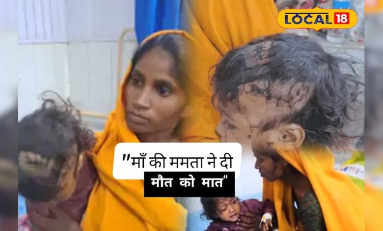 मदर्स डे पर मां बनी ढाल, कुत्ते से भिड़कर लहूलुहान बेटी को बचाया, सिर पर लगे 12 टांके
