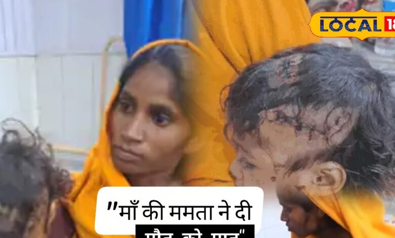 मां की बहादुरी को सलाम! दिखाया अद्भुत साहस, खूंखार कुत्ते के जबड़ों से ऐसे खींच लाई अपनी लाडली