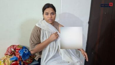झुलसी रेशु गुप्ता के इलाज का खर्च उठाएगी सरकार, दोषी पुलिसकर्मियों पर गिरी गाज