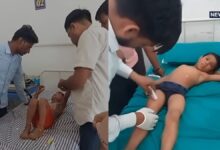 दौसा में स्कूल ऑटो का कुलेंट फटा, 3 बच्चे झुलसे, एक जयपुर रेफर