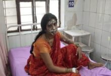 Alwar News: सिलेंडर में लगी आग से मकान में फैली भीषण लपटें, एक ही परिवार के तीन लोग गंभीर झुलसे