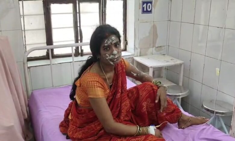 Alwar News: सिलेंडर में लगी आग से मकान में फैली भीषण लपटें, एक ही परिवार के तीन लोग गंभीर झुलसे