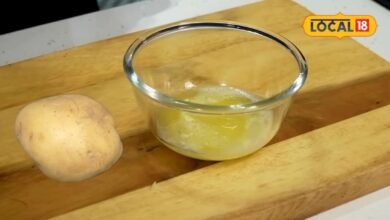 Dark circles removal tips : क्या आप भी डार्क सर्कल्स से परेशान? जानिए आलू और खीरे में कौन देगा जल्दी राहत